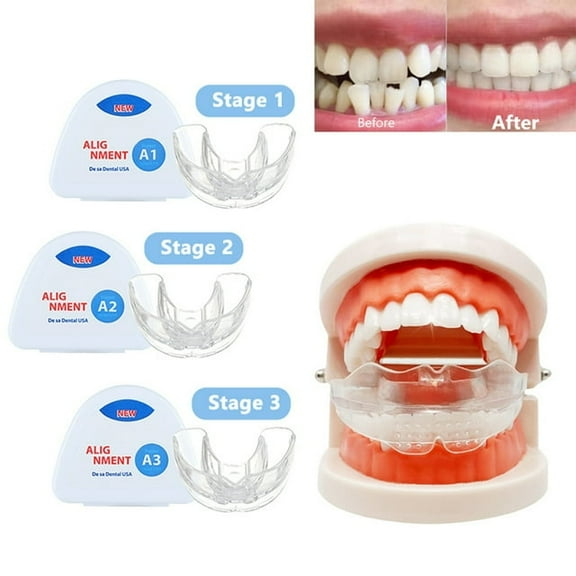 Dental Orthodontic Teeth Corrector,Dental Braces Kit,Mouth Guard Orthodontic Teeth Straightener Corrector 3 Stage Dental Braces Tooth Tray Retainer Straighten Aligner Trainer,Clear