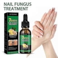 thumbnail image 4 of Jaysuing Ginger Nail Care Solution 30ml Nail Fungus Repair Hand, Foot Nail Care Soft Nail Bright -, 4 of 4