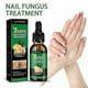 thumbnail image 4 of Jaysuing Ginger Nail Care Solution 30ml Nail Fungus Repair Hand, Foot Nail Care Soft Nail Bright -, 4 of 4