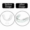 thumbnail image 3 of 15pcs Silicone Mouth Guard Night Teeth Clenching Grinding Sleep Dental Tool- Teeth Grinding Mouth Guard Compatible Sleep, 3 of 5