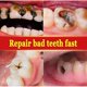 thumbnail image 4 of Toothpaste Repair Of Cavities Caries Removal Of Plaque Stains Teeth Whitening, 4 of 5