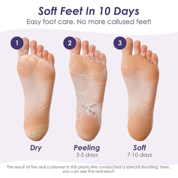 LEHOZIHEQ Peeling Foot Mask Exfoliating Foot Mask Socks Baby Feet Mask 1 Pair 38ml