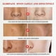 thumbnail image 2 of Crema blanqueadora eficaz para pecas, 20g, elimina el Melasma, pigmento para manchas de acné, manchas oscuras, crema hidratante blanqueadora para el cuidado de la piel Feliz Sencillez, 2 of 5