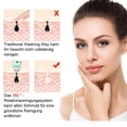 thumbnail image 2 of Facial Cleansing Brush, 4 in 1 Waterproof Electric Facial Brush Two-Way Rotation 3 Speeds USB Rechargeable Facial Cleansing Device for Deep Cleansing Gentle Exfoliation, 2 of 7