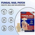 thumbnail image 3 of Fungal Nail Repair Patches, Waterproof Toenail Treatment & Correction Stickers for Damaged Nails_c*, 3 of 5