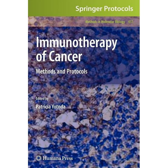 Methods in Molecular Biology Immunotherapy of Cancer: Methods and Protocols, Book 651, (Hardcover)