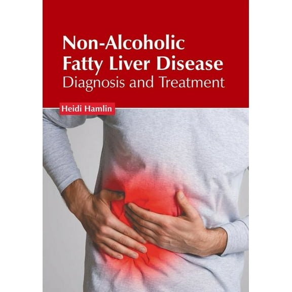 Non-Alcoholic Fatty Liver Disease: Diagnosis and Treatment, (Hardcover)