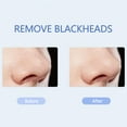thumbnail image 4 of Ultrasonic Skin Scrubber Skin Peeling Machine Facial Cleansing Shatter Blackheads Import Nutrition Lifting, 4 of 9
