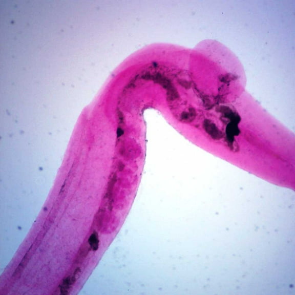 Schistosoma Japonicum Male Slide, W.M.