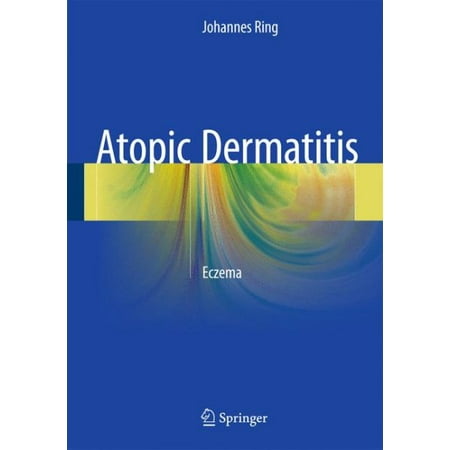 Atopic Dermatitis : Eczema