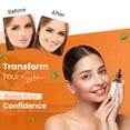 thumbnail image 4 of Sérum facial para piel con vitamina C natural antienvejecimiento 30 ml, 4 of 5
