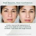 thumbnail image 4 of Gutaderme Alpha Arbutin + Hyaluronic Acid Serum for Face - Dark Spot Correction, Nourishing Elegance, Anti-Aging & Hydrating, Face Serum & Hylunaric Acid Moisturizer, 30ml/1fI.oz, 4 of 10