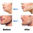 thumbnail image 3 of SHAR Jawline Shaper Exerciser - 3pcs Set for Men and Women, 3 of 5