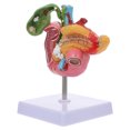 thumbnail image 4 of Human Pancreas Model Duodenal Gallbladder Pathological Model Teaching Instrument, 4 of 9