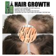 thumbnail image 4 of Spray para el crecimiento del cabello South Moon, 3 unidades | | B, 4 of 5