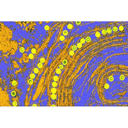 Coloured TEM of Herpes Simplex Viruses Inside Cell Print Wall Art By Dr. Linda
