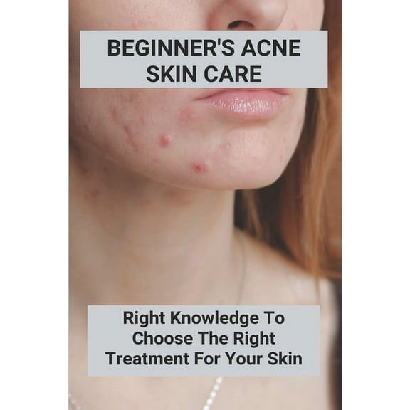 Beginner's Acne Skin Care: Right Knowledge To Choose The Right Treatment For Your Skin (New Edition): Hormonal Acne (Paperback)