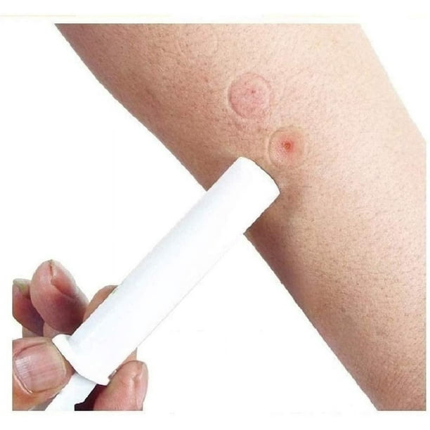 Kit de 2 piezas de succión para picaduras de mosquitos y abejas, suministros de primeros auxilios de emergencia de seguridad, herramienta de primeros auxilios natural para picaduras de mosquitos,