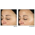 thumbnail image 2 of RoC Skincare - Sérum Quotidien Revitalisation + Éclat Multi Correxion 30mL, 2 of 7