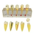 thumbnail image 3 of Modelo de Resina de de Enfermedad Modelos Materiales Educativos Médicos DYNWAVEMX Molde de práctica dental, 3 of 6