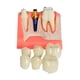 thumbnail image 3 of Modelo de implante,Modelo de implante para la educación del paciente,Presentación con puente coronal removible,Práctica de enseñanza con modelo dental 4 veces,Clase de demostración, 3 of 9