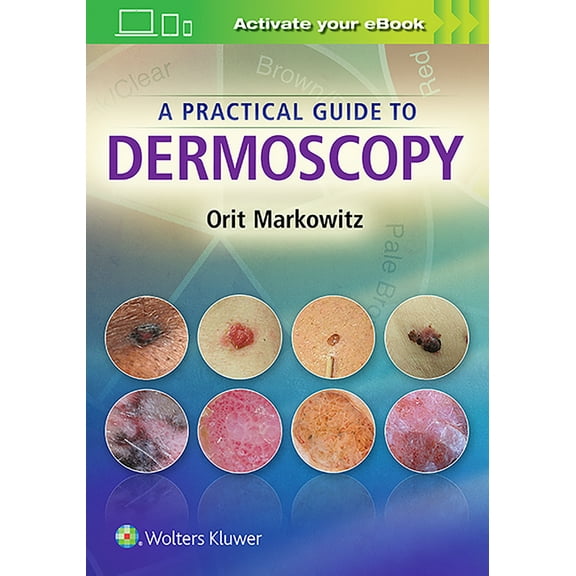 A Practical Guide to Dermoscopy, (Hardcover)
