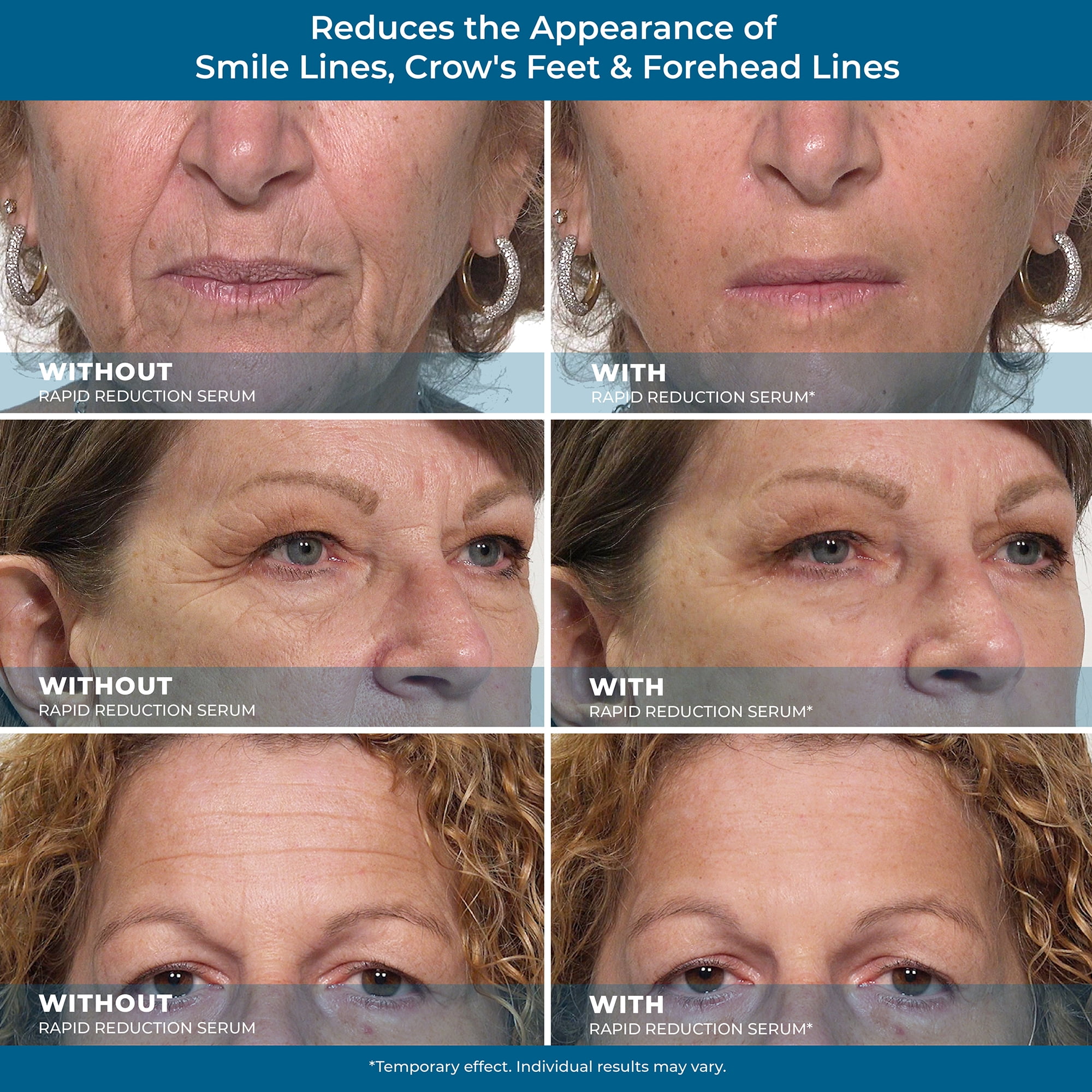 Plexaderm Rapid Reduction Serum - New Single Use Pods - Age-Defying Eye Treatment - Reduce the Look of Under-Eye Bags & Wrinkles, Diminish the Appearance of Dark Circles, Fine Lines &a