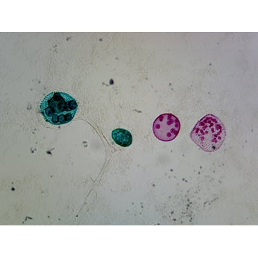 Volvox Sexual Reproduction; Showing Sex Cells; Whole-mount by Go Science Crazy