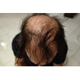 thumbnail image 3 of Hair Fiber Empty Finally Hair Fiber Applicator Bottle, 3 of 5