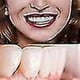 thumbnail image 2 of Smile Snap On Teeth Upper Lower Dental Veneers Dentures Tooth Cover Set, 2 of 5