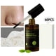 thumbnail image 1 of de eliminación de espinillas de 15 ml, suero exfoliante esencial para la frente de la del té para el atención facial del acné c Yinane Suero de eliminación de puntos negros, 1 of 8