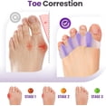 thumbnail image 2 of Promifun Toe Separators, 8 Pack Bunion Corrector for Women/Men, Soft Toe Spacers with Lavender Extract - Dividers to Correct Bunions, Hammertoes, Overlapping Toes (Lavender), 2 of 7