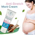 thumbnail image 5 of Stretch Mark Removal Cream For Pregnant Women - Anti-aging, Anti-wrinkles, Skin Elasticity Boost Smooth Skin Care, 5 of 5