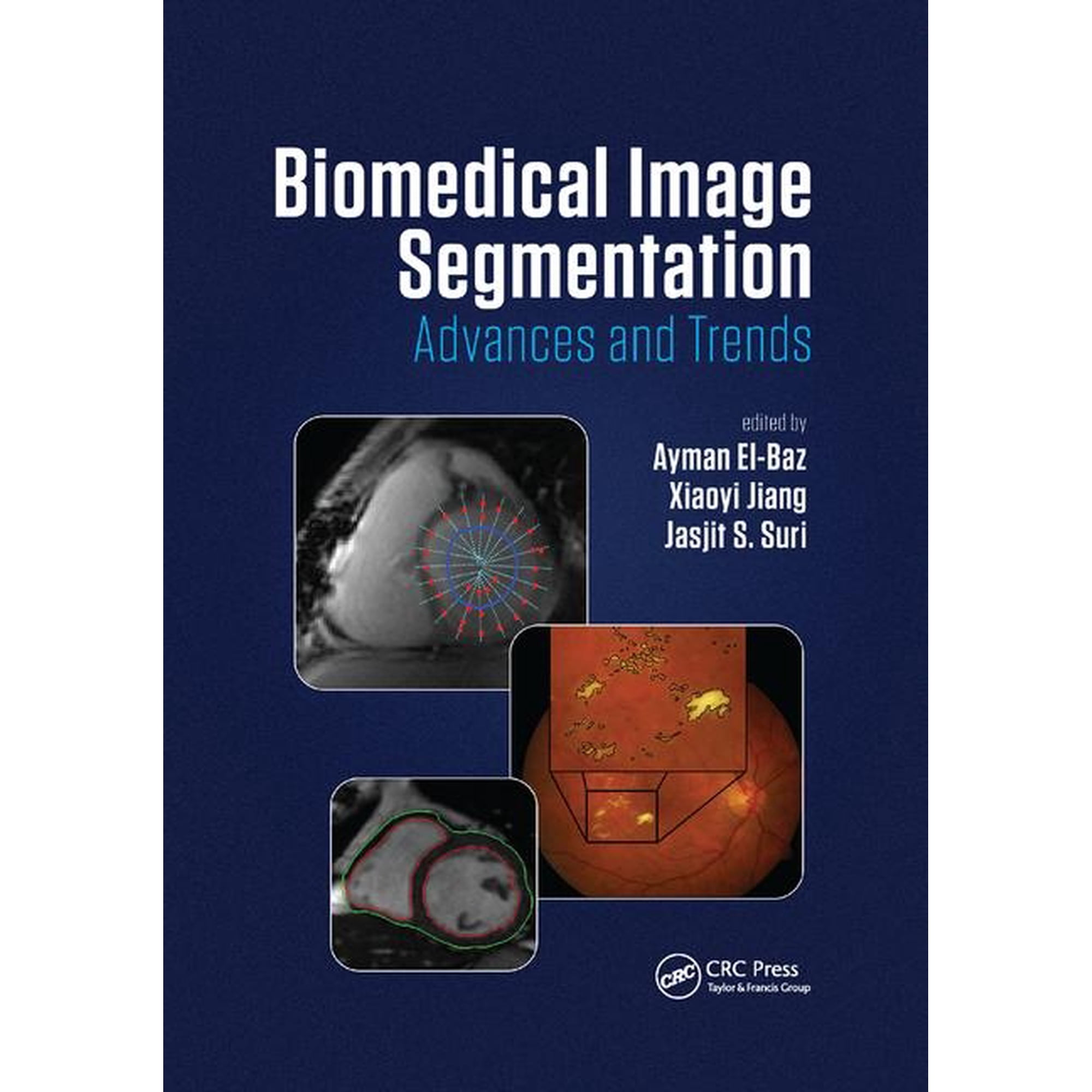 Biomedical Image Segmentation: Advances and Trends (Paperback)