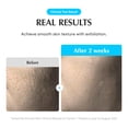 thumbnail image 4 of EQQUALBERRY T&oacute;nico Facial Coreano Milk Toner 300 ml &ndash; Tonico Hidratante Facial Exfoliante Suave Sin Alcohol Para Piel Sensible pH Bajo, 4 of 9