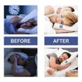 thumbnail image 2 of Sleep Good Night Cartoon Stickers Help Sleep Fast At Night Care Sleep Quality Sleep Patch - 28Pcs, 2 of 2
