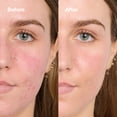 thumbnail image 6 of Bubble Skincare Secret Agent Color Correcting Balm Redness Fix - 0.5oz: Face Moisturizer, Paraben-Free, Gluten-Free, Normal Skin, 6 of 8