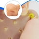 thumbnail image 5 of Juguete realista para reventar espinillas, broma para piel, táctil, con pinzas, removedor de puntos negros., 5 of 9