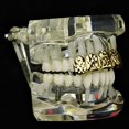 thumbnail image 3 of 14k Gold Plated Grillz Diamond-Cut Bling Grill Top Upper Six 6 Teeth Hip Hop Mouth Grills, 3 of 5