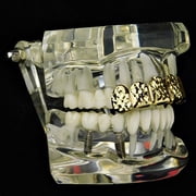 14k Gold Plated Grillz Diamond-Cut Bling Grill Top Upper Six 6 Teeth Hip Hop Mouth Grills