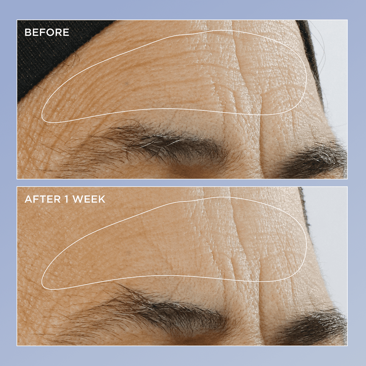 High Potency Triple Retinol Renewal Serum