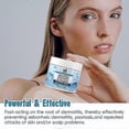thumbnail image 2 of anti fungal treatment for seborrheic dermatitis and dry scalp, 2 of 5