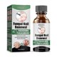 thumbnail image 1 of Onychomyx Nail Repair Nourishing Solution To Onyx Nails Bright Nails, 1 of 5