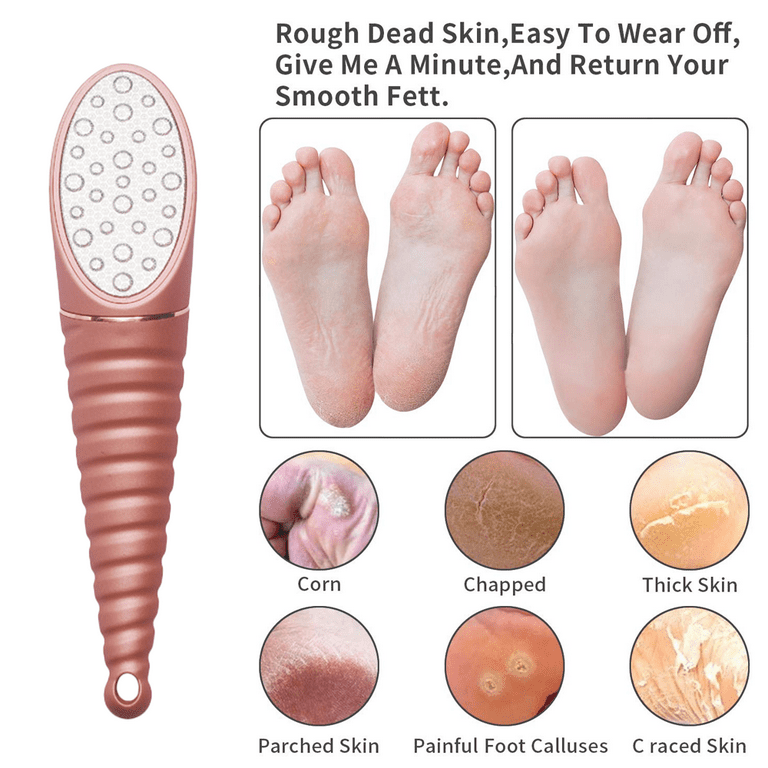 Dead Skin Remover for Feet - Pedicure Foot Egg File Callus Remover and Foot  Peeler 