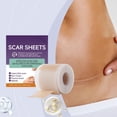 thumbnail image 4 of New Silicone Scar Patch Effectively Removes Scars And Reduces Marks Suitable For All Skin Types Continuous Use Restores Skin Health Xi-B07-0301-01, 4 of 7