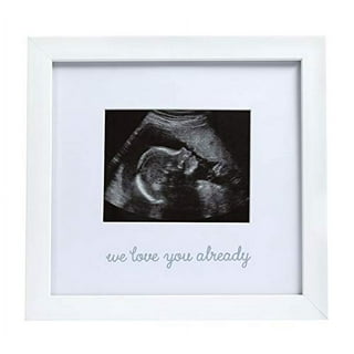  trlry Triple Ultrasound Picture Frames, Sonogram Picture Frame  3 Photos,Pregnancy Announcements,Pregnancy Gifts for First Time Moms,First  Time Mom Gift,Black,Ultrasound Photo Album : Baby