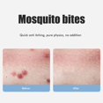 thumbnail image 4 of Herramienta para aliviar las picaduras de insectos de rosas, bolígrafo electrónico antipicazón para calentar picaduras de insectos, sin productos químicos, dispositivo antipicazón para picaduras de mosquitos, picaduras de insectos, picaduras de abeja, espinas de avispa, JM, 4 of 5
