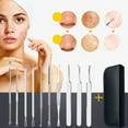 thumbnail image 2 of Kit de 10 herramientas para eliminar puntos negros y granos, extractor de comedones para eliminar puntos negros y granos en la nariz y la piel del rostro, 2 of 7