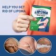 thumbnail image 4 of Parche Para Aliviar La Grasa De Lipólisis, 30 Hojas Reducen El Dolor, Parche Eficaz Para Eliminar El Lipoma Sin Dolor Para La Mano, 4 of 7