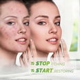 thumbnail image 3 of Psoriasis Treatments Cream, Psoriasis Cream, Anti-itch Cream, Soothing Cream for Psoriasis, Relieves Itching and Soothes Irritated Skin, 3 of 5
